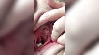 Huge kegel balls pushed out of pussy