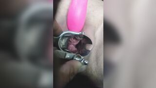 close up speculum and internal veiw of squirting