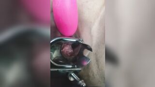 close up speculum and internal veiw of squirting