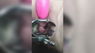 close up speculum and internal veiw of squirting